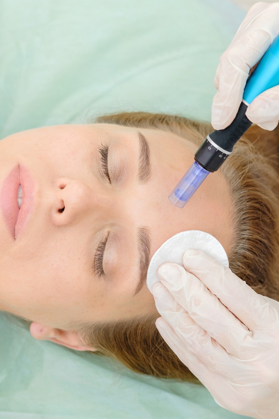 Pack Microneedling Collagen Induction