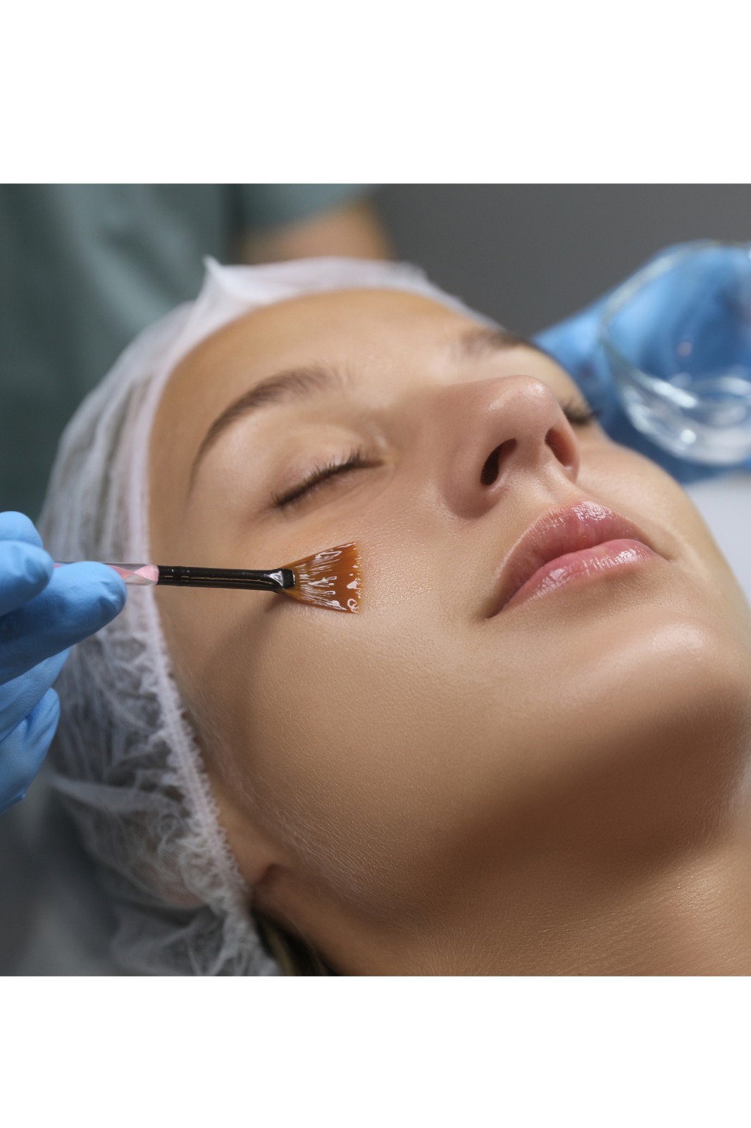 Peeling aux acides de fruits Mesopeel