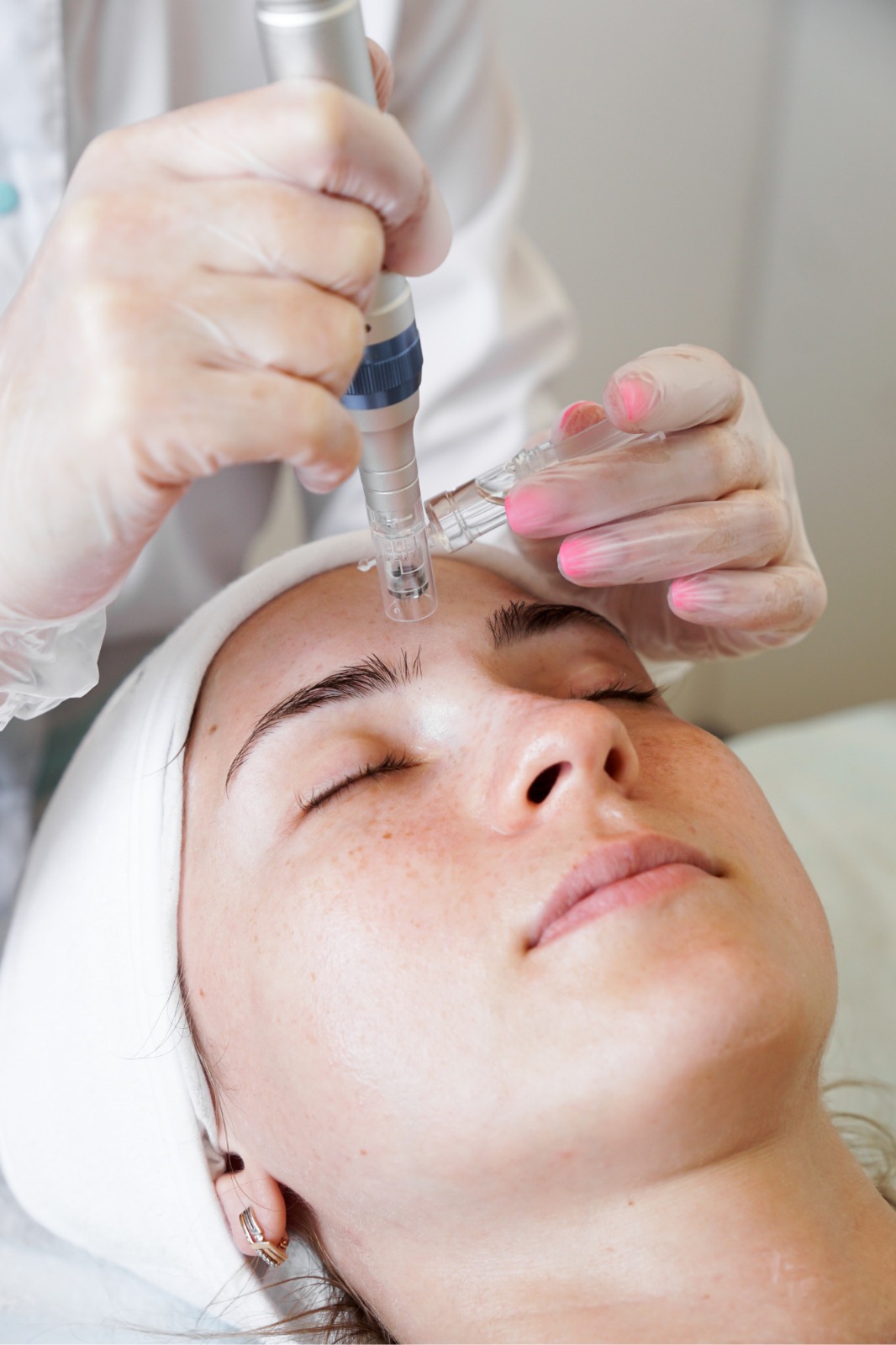 Pack Peeling et Microneedling