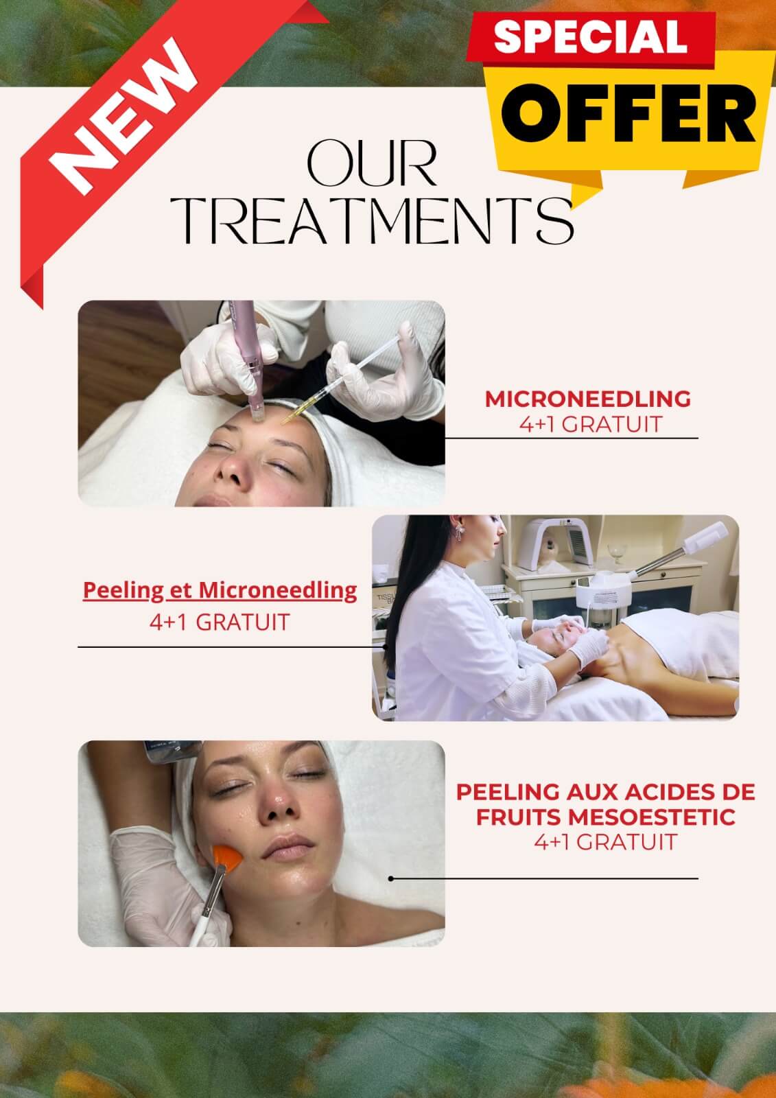 Offres spéciales du centre d'étsthetique Lys Institut et bien être : Image présentant deux de leurs traitements. Le premier est 'Microneedling' avec une offre 4+1 gratuit, montrant une spécialiste traitant le visage d'une cliente. Le deuxième est 'Peeling aux acides de fruits Mesosetetic' avec également une offre 4+1 gratuit, illustré par une image d'une cliente recevant un traitement de peeling.
